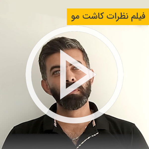 فیلم نظرات کسانی که کاشت مو انجام داده اند